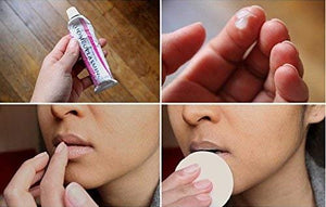 Homeoplasmine, XL - 40g Magic Cream - For Dry Skin, Irritations, for Soft Lips! [ The Original French Packaging ]